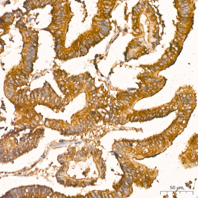 NFkB p65 Antibody in Immunohistochemistry (Paraffin) (IHC (P))