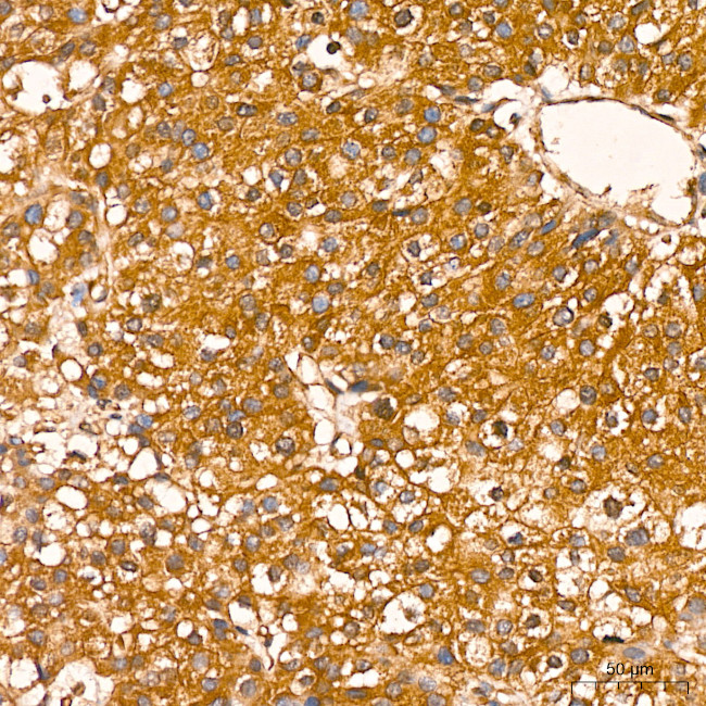 NFkB p65 Antibody in Immunohistochemistry (Paraffin) (IHC (P))