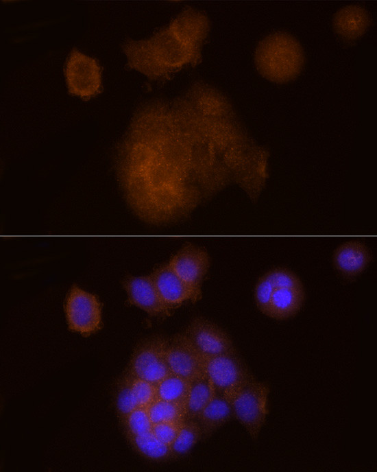 SOCS1 Antibody in Immunocytochemistry (ICC/IF)