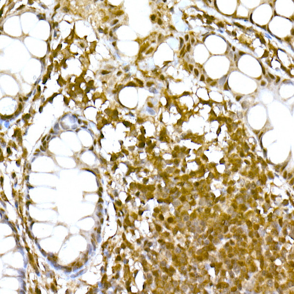 SOCS1 Antibody in Immunohistochemistry (Paraffin) (IHC (P))