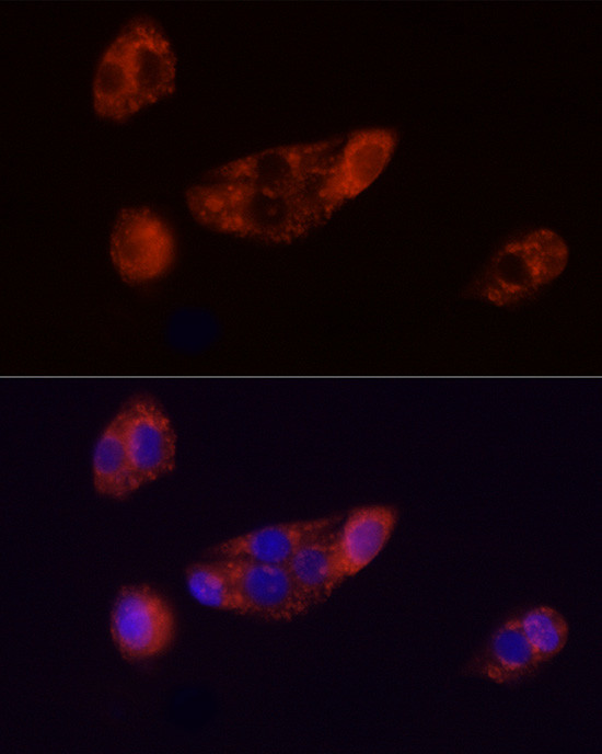 ADFP Antibody in Immunocytochemistry (ICC/IF)