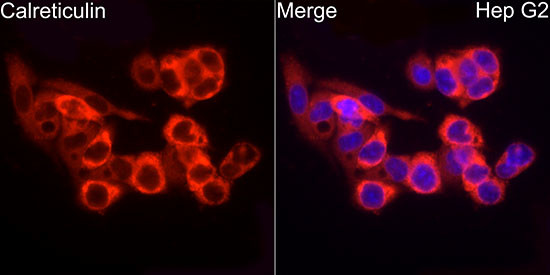 Calreticulin Antibody in Immunocytochemistry (ICC/IF)