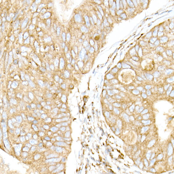 Calreticulin Antibody in Immunohistochemistry (Paraffin) (IHC (P))