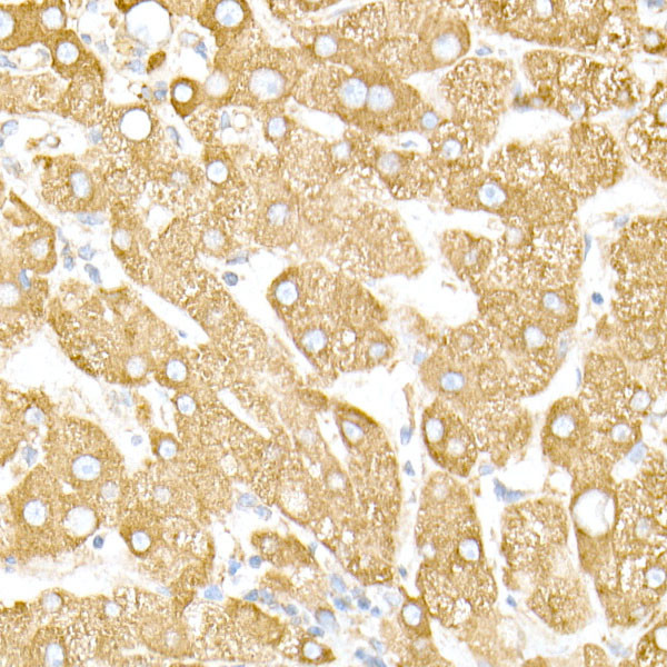 Calreticulin Antibody in Immunohistochemistry (Paraffin) (IHC (P))