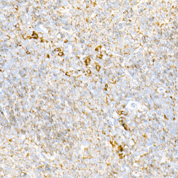 Calreticulin Antibody in Immunohistochemistry (Paraffin) (IHC (P))