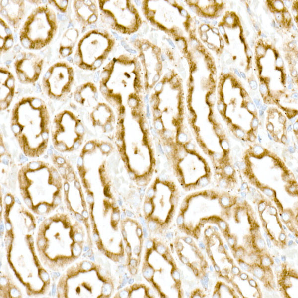 Calreticulin Antibody in Immunohistochemistry (Paraffin) (IHC (P))