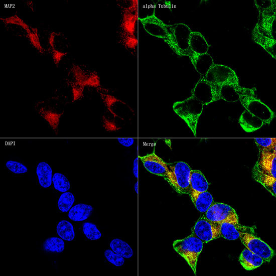 MAP2 Antibody in Immunocytochemistry (ICC/IF)