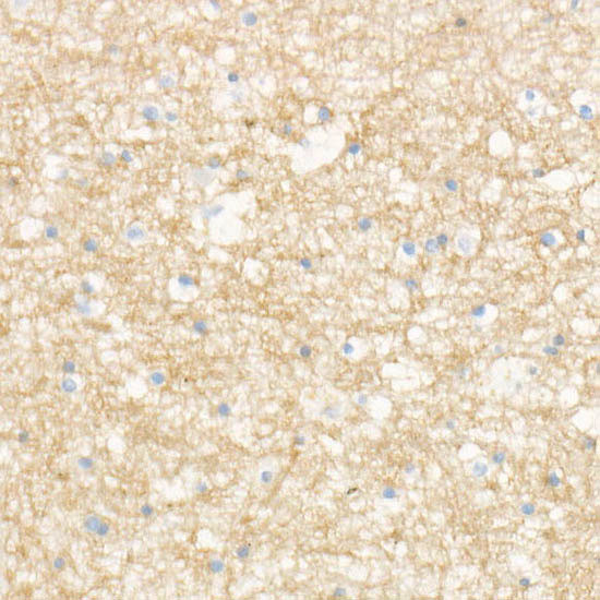 MAP2 Antibody in Immunohistochemistry (Paraffin) (IHC (P))