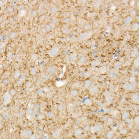 MAP2 Antibody in Immunohistochemistry (Paraffin) (IHC (P))