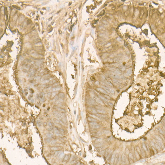 CEA Antibody in Immunohistochemistry (Paraffin) (IHC (P))