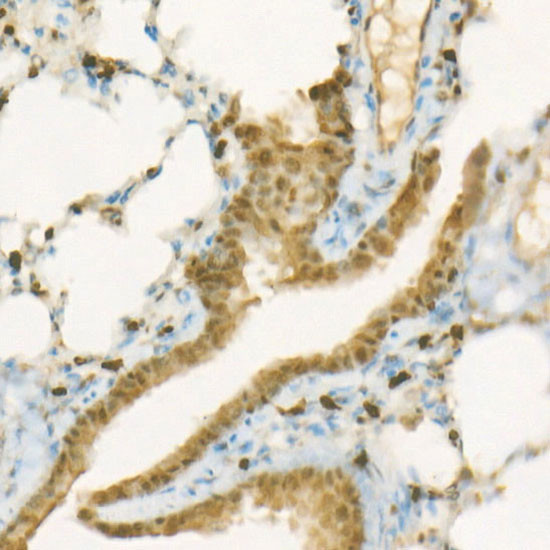 ATP Citrate Lyase Antibody in Immunohistochemistry (Paraffin) (IHC (P))