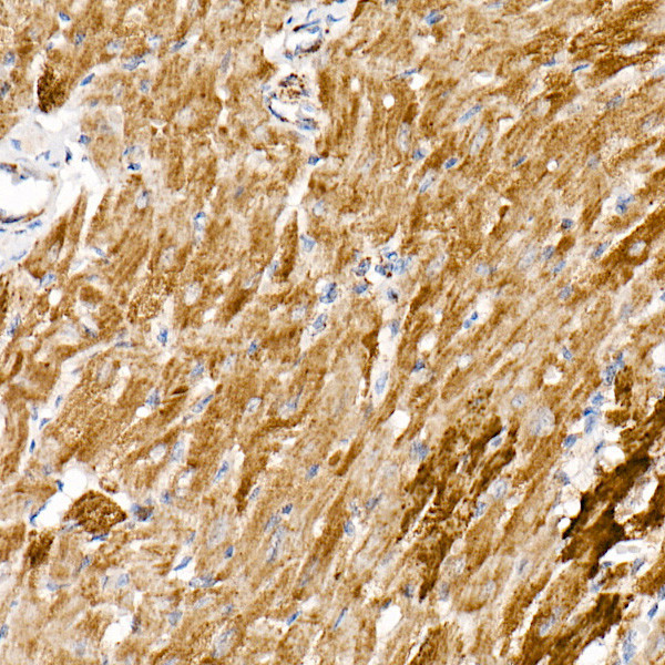 NDUFS1 Antibody in Immunohistochemistry (Paraffin) (IHC (P))