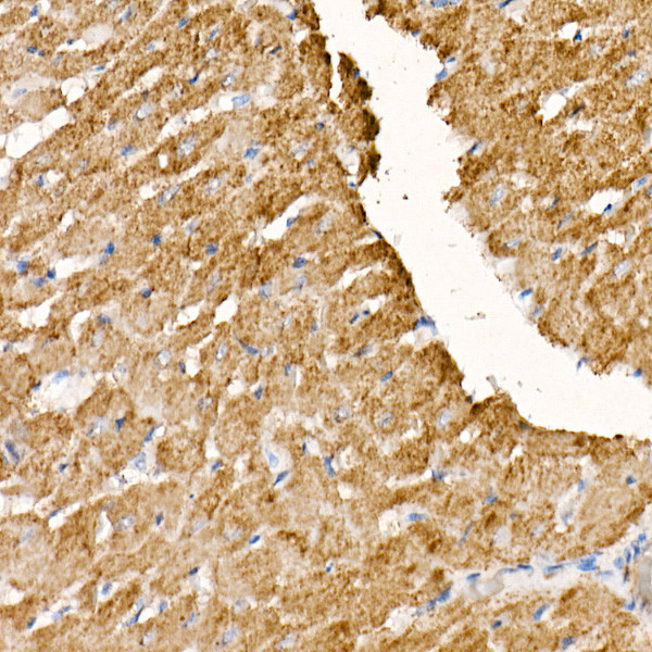 NDUFS1 Antibody in Immunohistochemistry (Paraffin) (IHC (P))