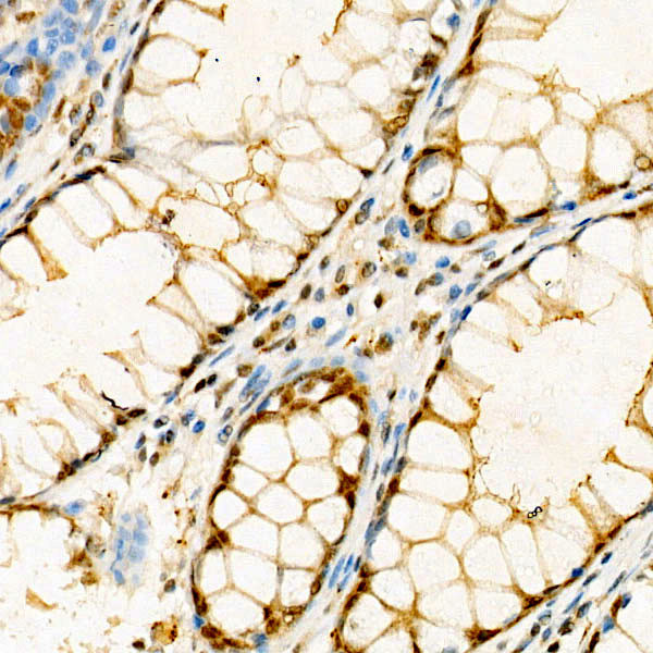 IP6K1 Antibody in Immunohistochemistry (Paraffin) (IHC (P))