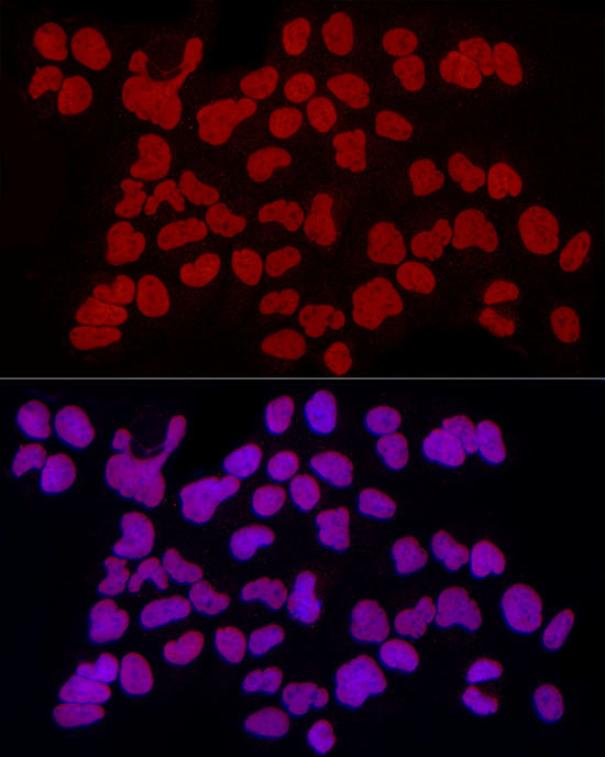 RbAp46 Antibody in Immunocytochemistry (ICC/IF)