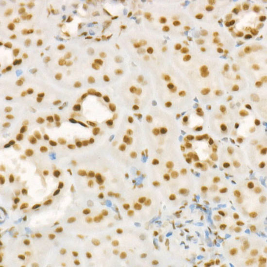 RbAp46 Antibody in Immunohistochemistry (Paraffin) (IHC (P))