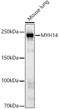 MYH14 Antibody in Western Blot (WB)