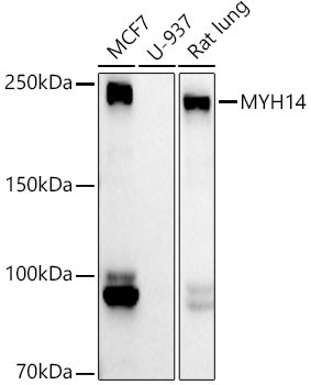 MYH14 Antibody in Western Blot (WB)