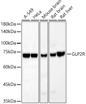 GLP2R Antibody in Western Blot (WB)