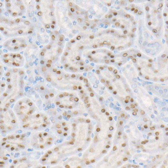 HNF1A Antibody in Immunohistochemistry (Paraffin) (IHC (P))