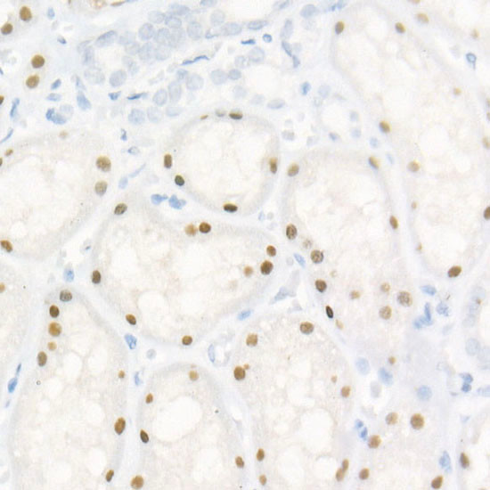 HNF1A Antibody in Immunohistochemistry (Paraffin) (IHC (P))