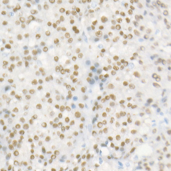 HNF1A Antibody in Immunohistochemistry (Paraffin) (IHC (P))