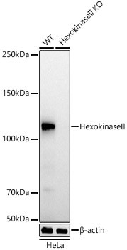 HK2 Antibody in Western Blot (WB)