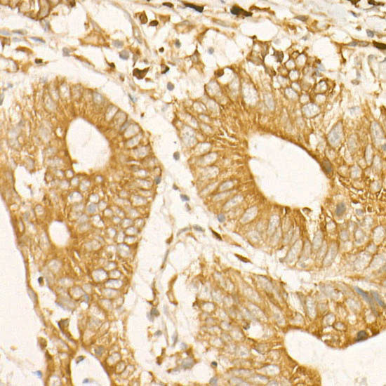 ADAM9 Antibody in Immunohistochemistry (Paraffin) (IHC (P))