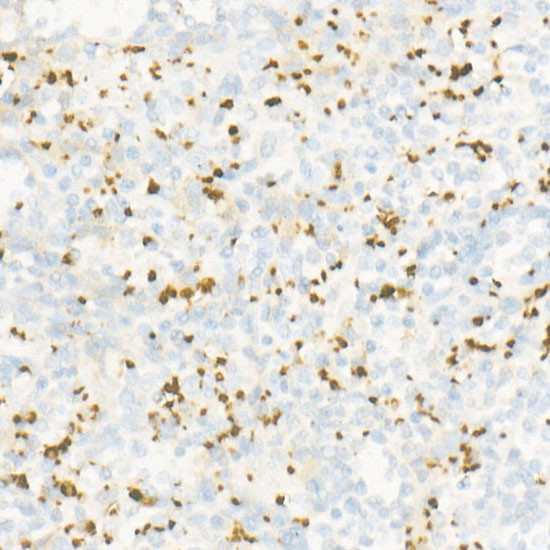 CD42b Antibody in Immunohistochemistry (Paraffin) (IHC (P))