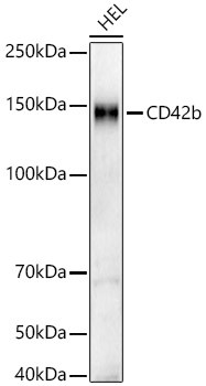 CD42b Antibody in Western Blot (WB)