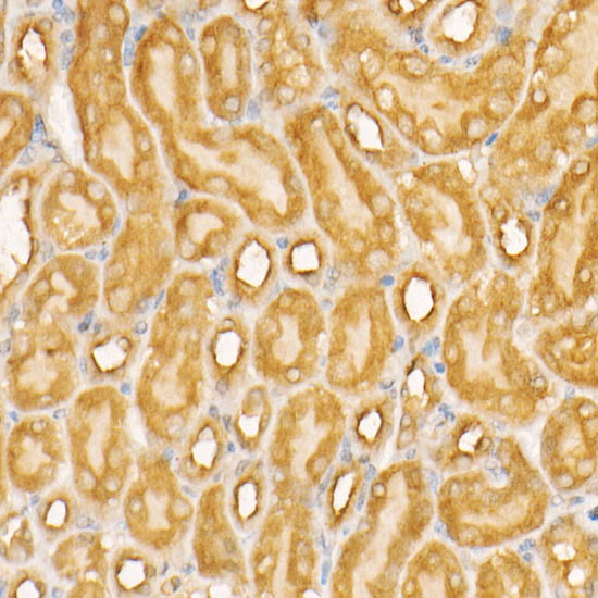 NOX4 Antibody in Immunohistochemistry (Paraffin) (IHC (P))