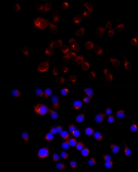 NF-H Antibody in Immunocytochemistry (ICC/IF)