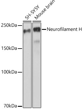 NF-H Antibody in Western Blot (WB)