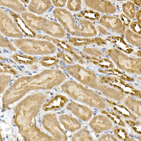 ERK1/ERK2 Antibody in Immunohistochemistry (Paraffin) (IHC (P))