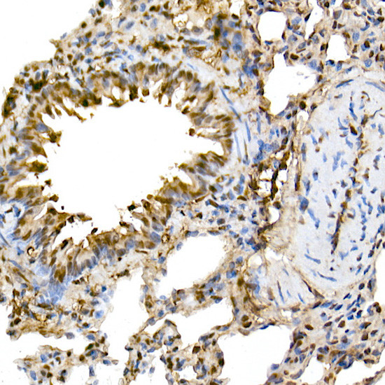 ERK1/ERK2 Antibody in Immunohistochemistry (Paraffin) (IHC (P))