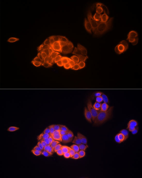 MMP13 Antibody in Immunocytochemistry (ICC/IF)