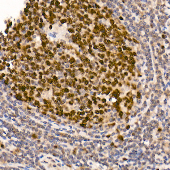 DNMT1 Antibody in Immunohistochemistry (Paraffin) (IHC (P))