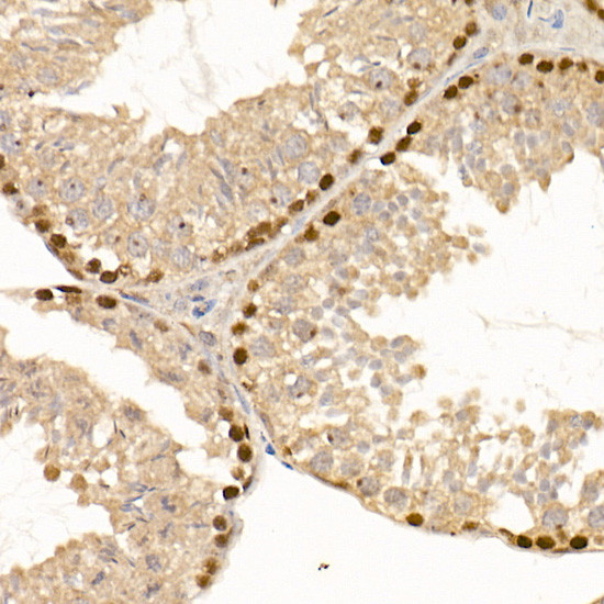 DNMT1 Antibody in Immunohistochemistry (Paraffin) (IHC (P))