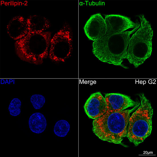 ADFP Antibody in Immunocytochemistry (ICC/IF)