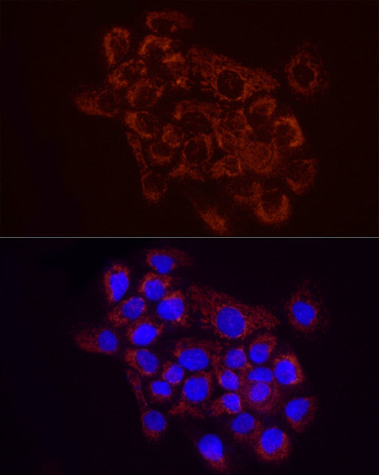 SDHC Antibody in Immunocytochemistry (ICC/IF)