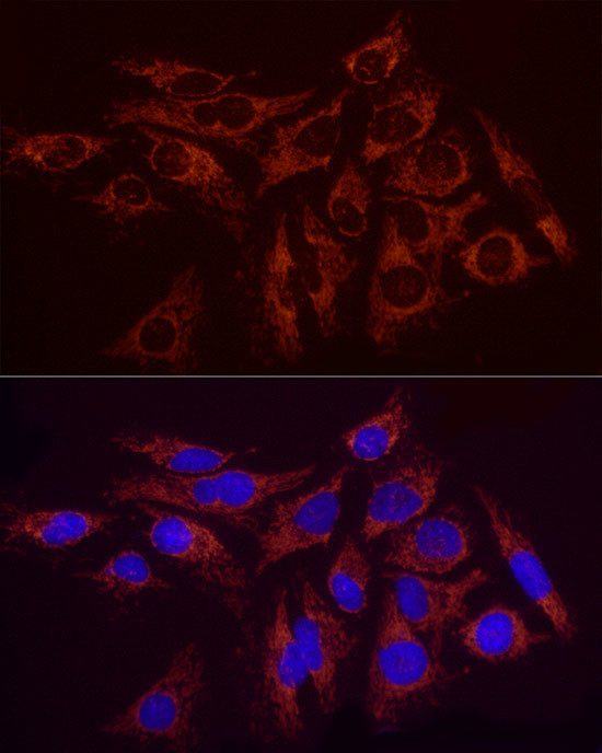 SDHC Antibody in Immunocytochemistry (ICC/IF)