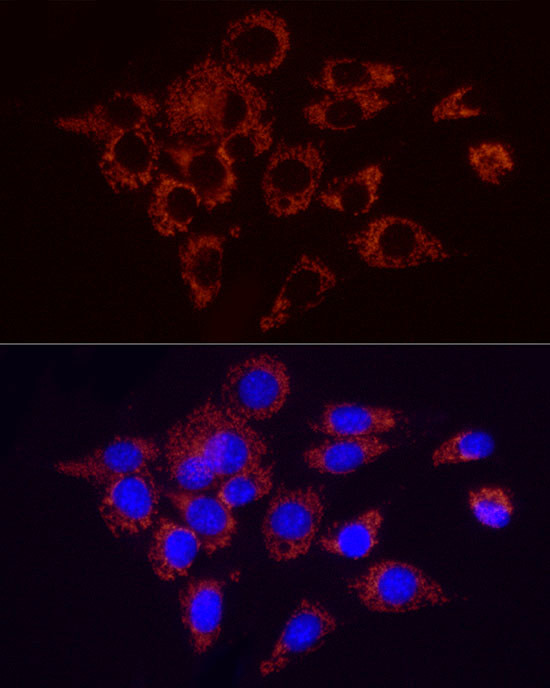 SDHC Antibody in Immunocytochemistry (ICC/IF)