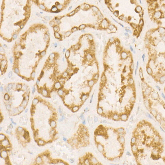 SDHC Antibody in Immunohistochemistry (Paraffin) (IHC (P))