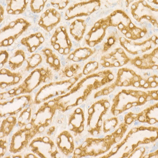 SDHC Antibody in Immunohistochemistry (Paraffin) (IHC (P))