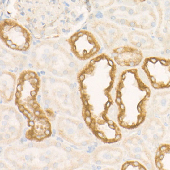 SDHC Antibody in Immunohistochemistry (Paraffin) (IHC (P))