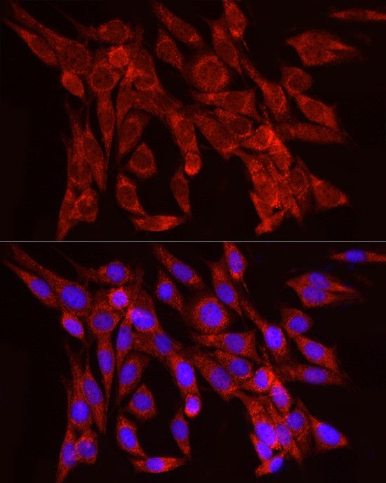 FGF2 Antibody in Immunocytochemistry (ICC/IF)