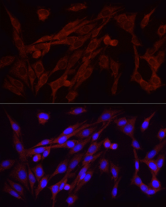 FGF2 Antibody in Immunocytochemistry (ICC/IF)