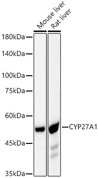 CYP27A1 Antibody in Western Blot (WB)