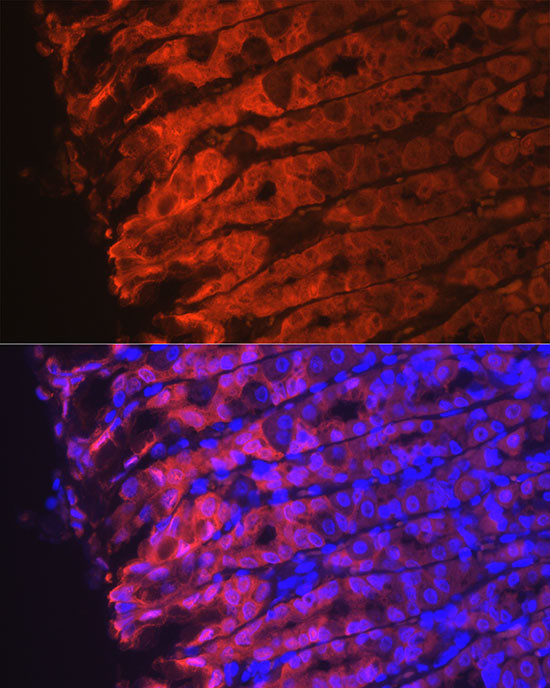 NQO1 Antibody in Immunocytochemistry (ICC/IF)