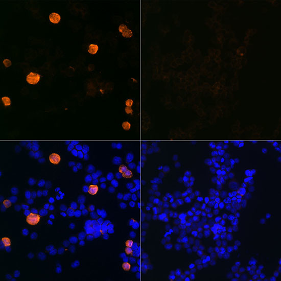 SARS-CoV-2 3CLpro Antibody in Immunocytochemistry (ICC/IF)